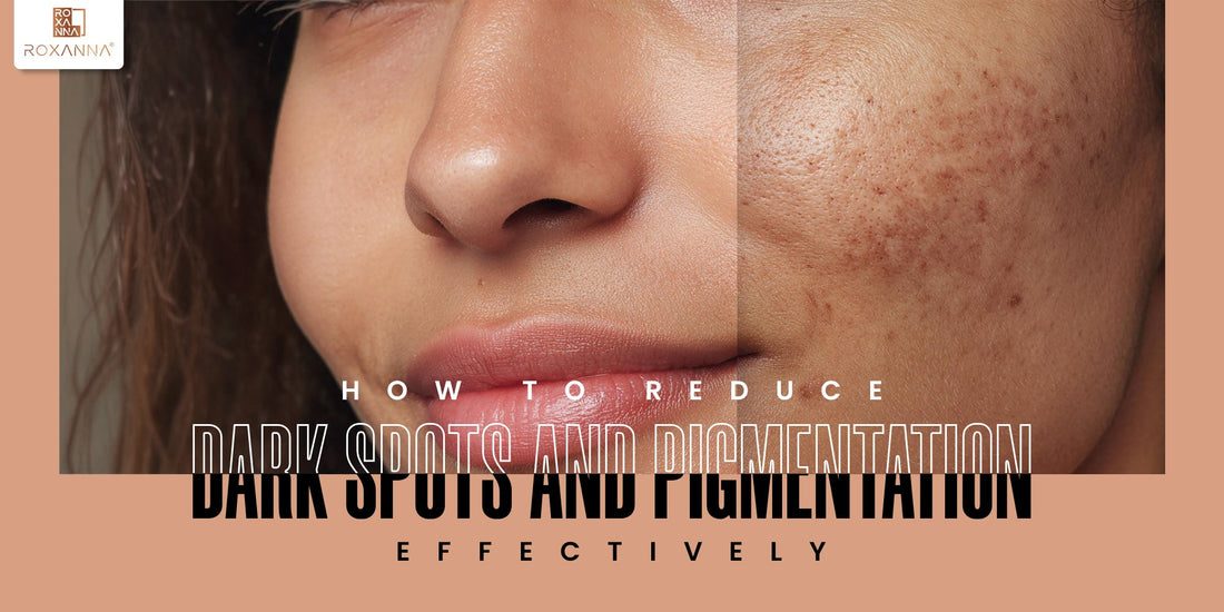 How to Reduce Dark Spots and Pigmentation Effectively