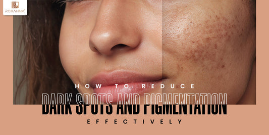 How to Reduce Dark Spots and Pigmentation Effectively